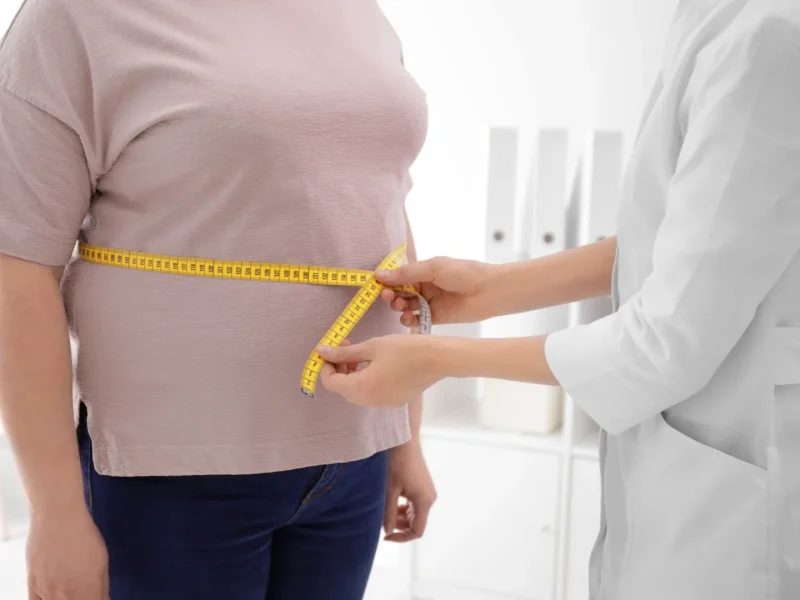 ¿Cuándo está indicada la Cirugía Bariátrica? Criterios Médicos