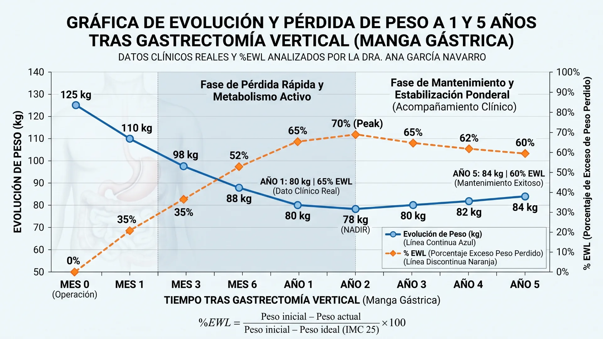 Gráfica de evolución y pérdida de peso a 1 y 5 años tras una gastrectomía vertical analizada por la Dra. Ana García Navarro